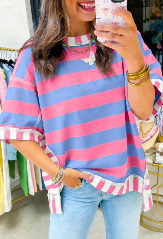 #956 Striped Oversized Top